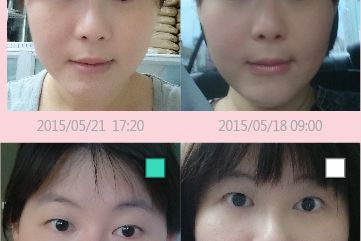 1040731-Facial APP-05.jpg