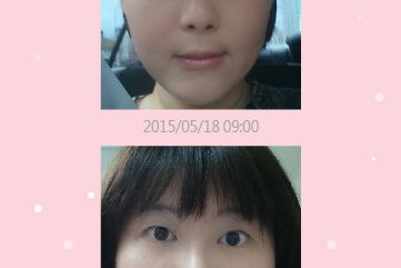1040731-Facial APP-07.jpg