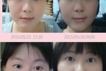 1040731-Facial APP-04.jpg