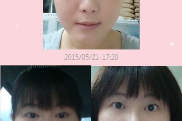 1040731-Facial APP-08.jpg